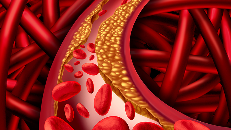 Does inhibiting the formation of the new blood vessels aid in