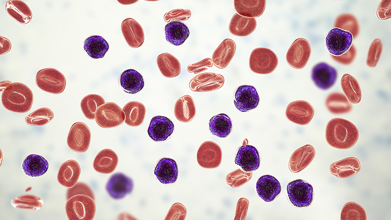 acute lymphoblastic leukemia cell illustration