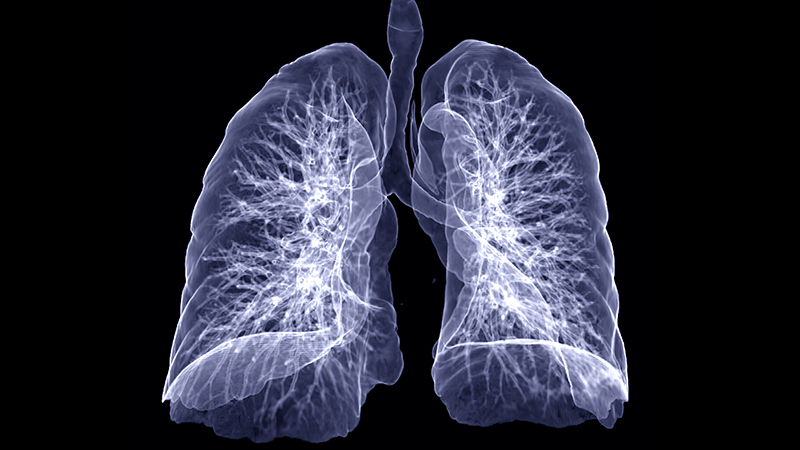 lung scan illustration
