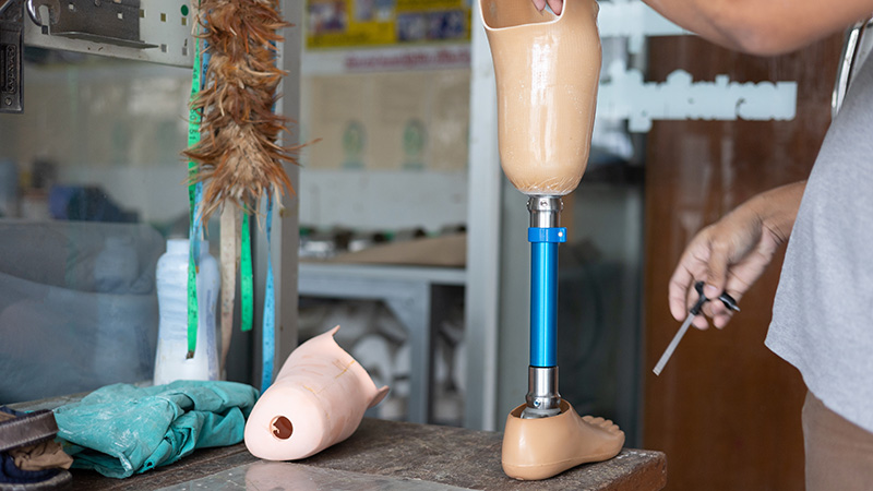 lower limb prosthetic