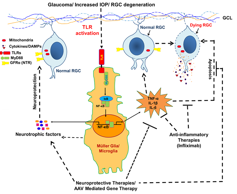 Role of innate immunity in glaucoma pathobiology and discovery of neuroprotective therapies