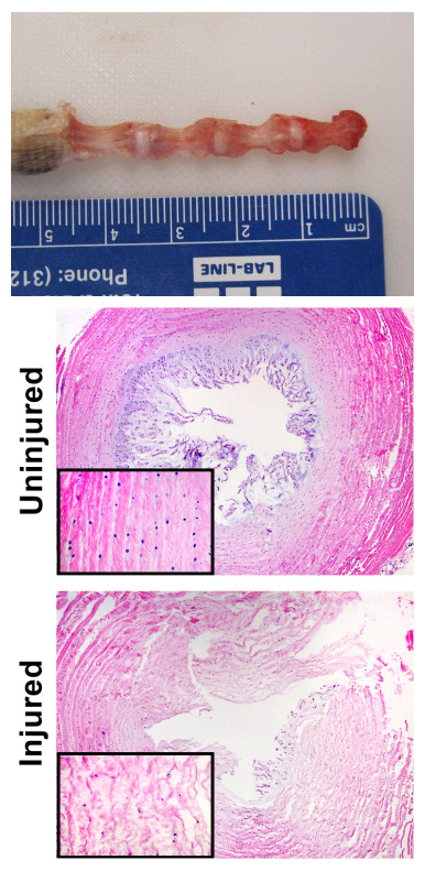 rat spinal discs (top) seen microscopically (bottom)