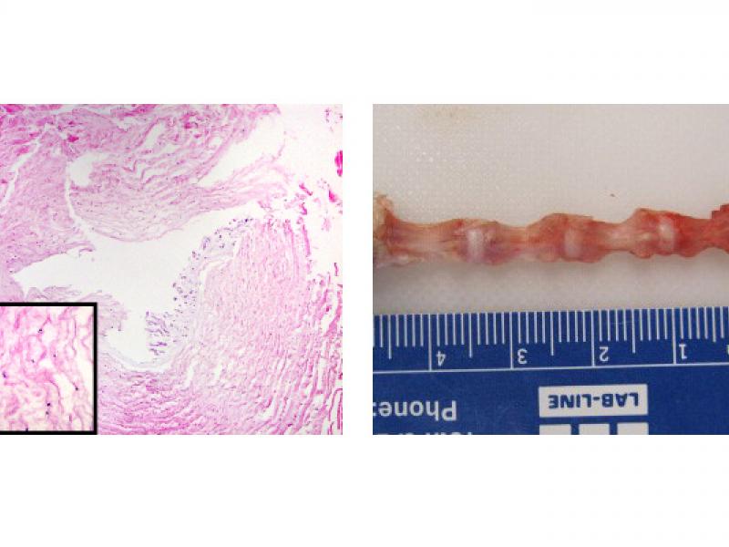 rat spinal discs seen microscopically