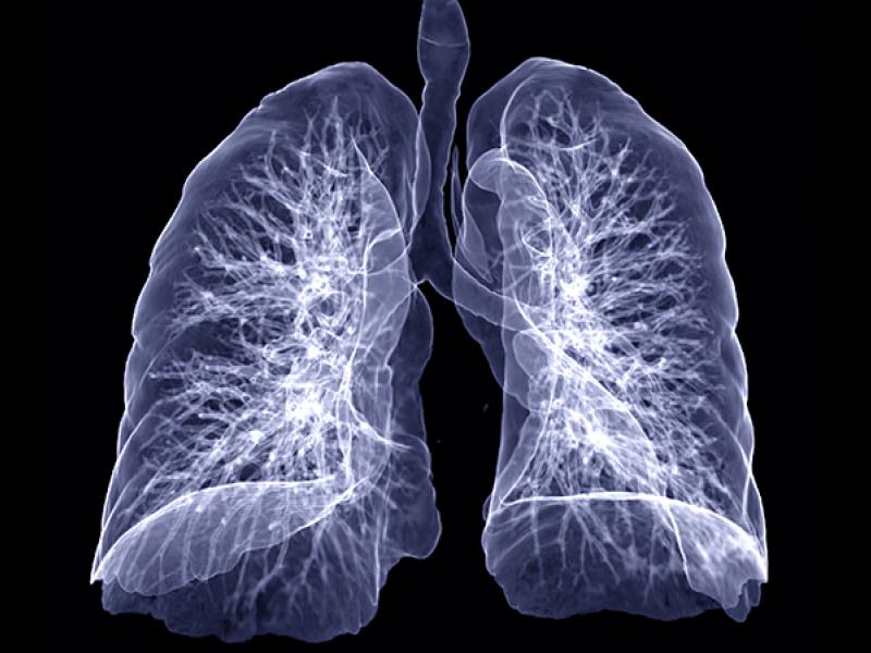 lung scan illustration